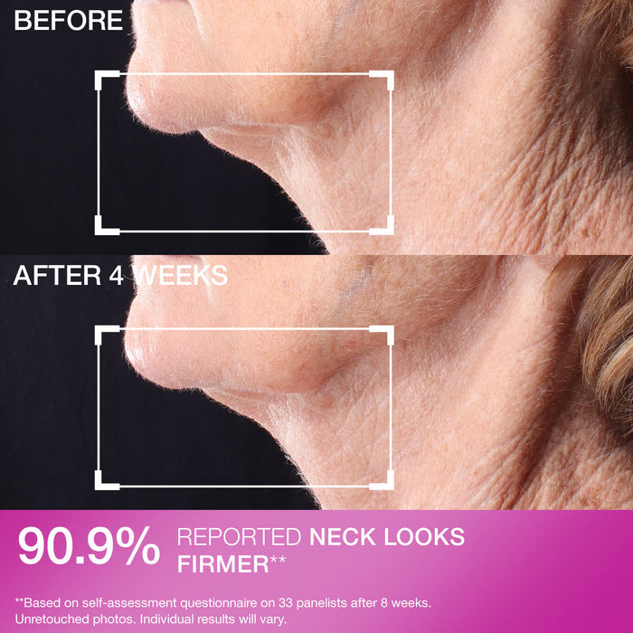 Peptight® Tightening Neck Serum Roller