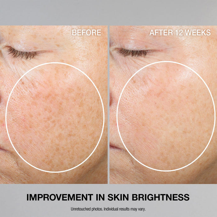 Super-C Retinol Brighten Correct Vitamin C Serum