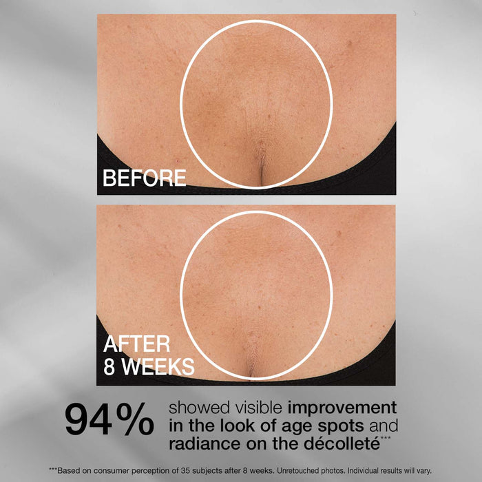 TL Advanced® Tightening Neck Cream PLUS