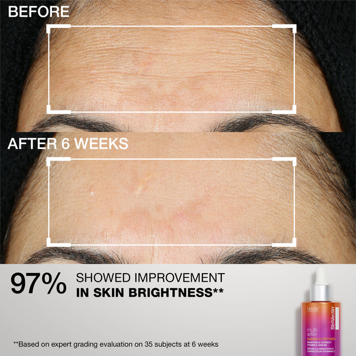 Better Brightening: Super C Routine