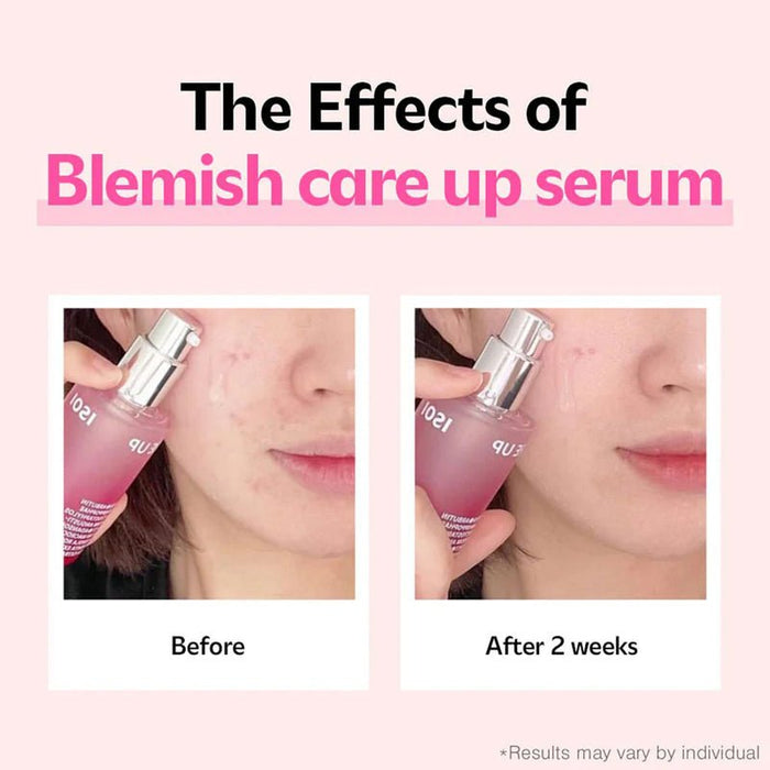Isoi Blemish Care Up Serum 35ml. مصل ايزوي للعناية بالعيوب - Princess Cosmetics Qatar