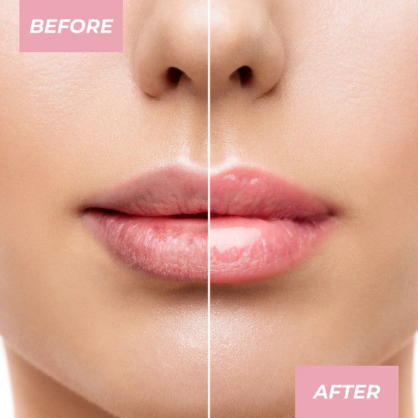 MCoBeauty Overnight Lip Mask