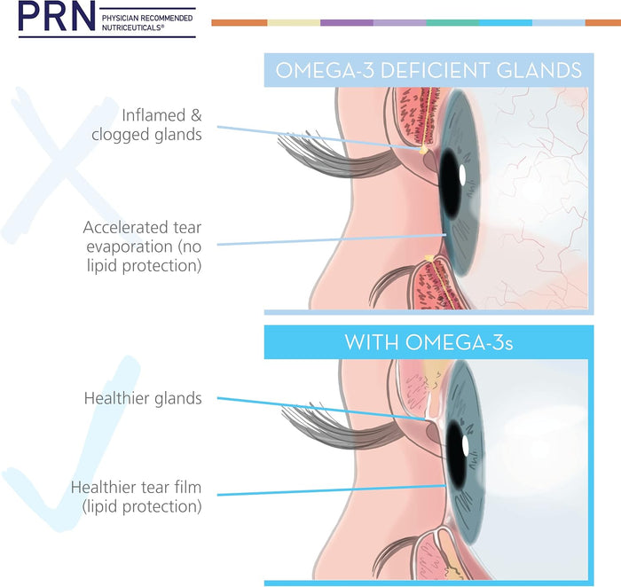 PRN De3 Dry Eye Omega Benefits®
