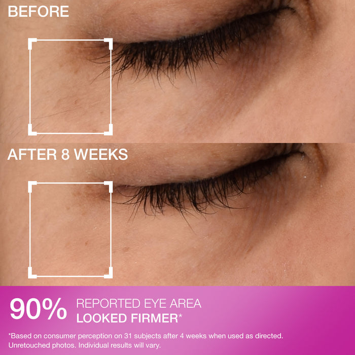 Super-C Dark Circle Brightening Eye Serum