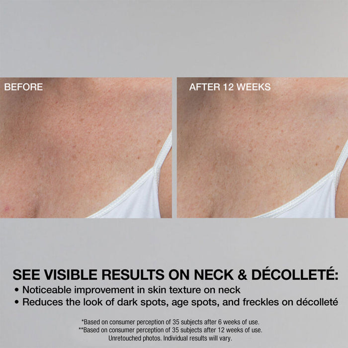 Super-C Retinol Brighten Correct Vitamin C Serum