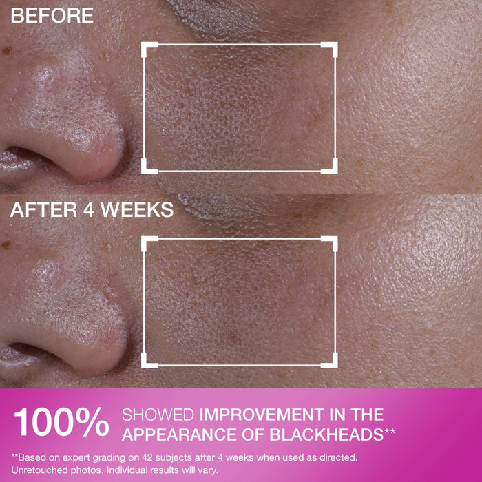 Super Shrink Pore Minimizing Serum