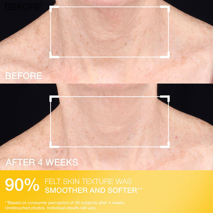 TL Advanced® Tightening Neck Cream Light