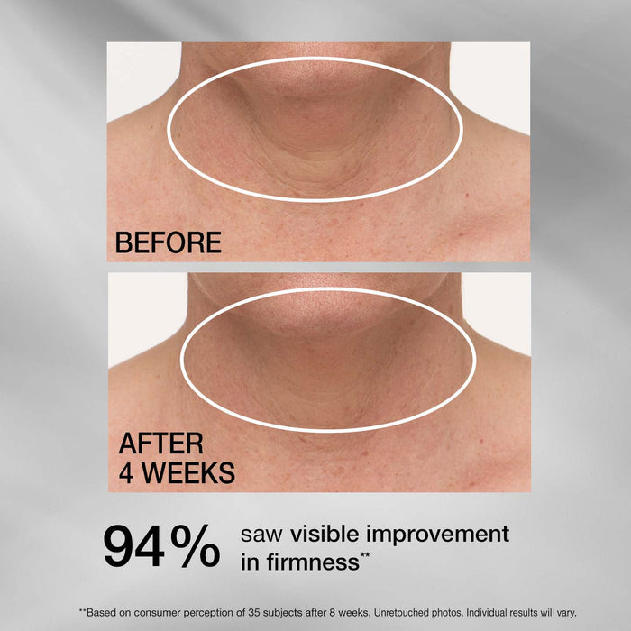 TL Advanced® Tightening Neck Cream PLUS