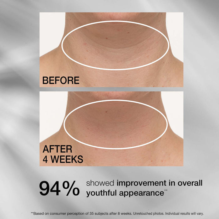 TL Advanced® Tightening Neck Cream PLUS